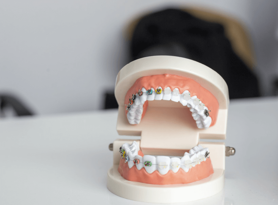 More Than Just Pearly Whites: The Link Between Oral Health and Overall Wellness